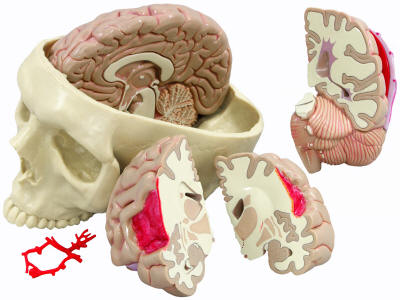 Brain Inside Skull